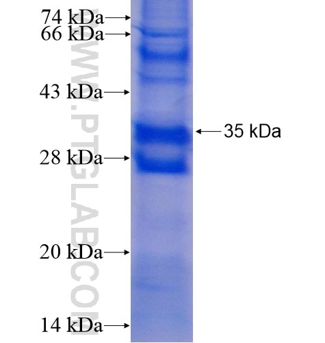 ST6GALNAC3 fusion protein Ag5189 SDS-PAGE