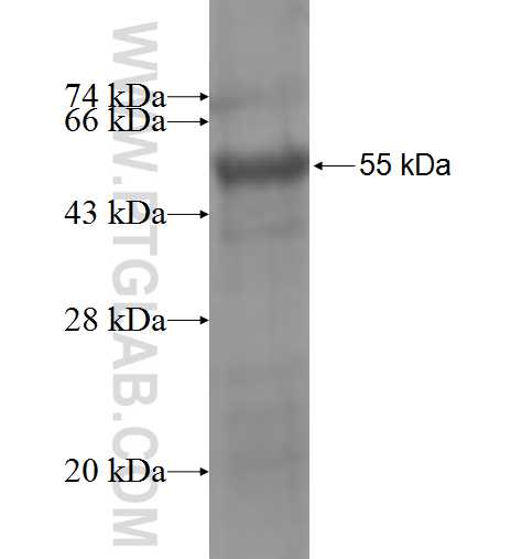 ST6GALNAC3 fusion protein Ag5207 SDS-PAGE