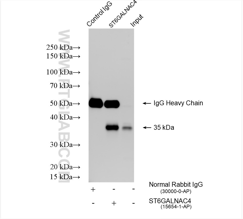 Immunoprecipitation (IP) experiment of HeLa cells using ST6GALNAC4 Polyclonal antibody (15654-1-AP)
