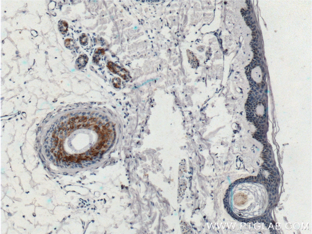 Immunohistochemistry (IHC) staining of human skin tissue using ST6GALNAC5 Polyclonal antibody (16442-1-AP)