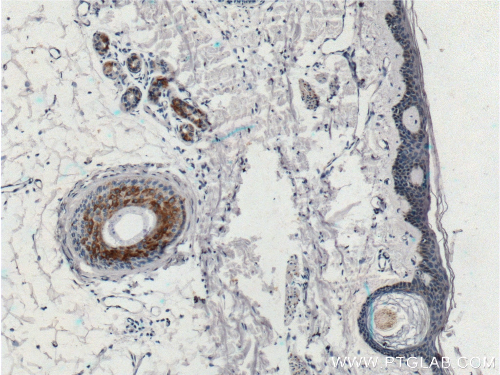 IHC staining of human skin using 16442-1-AP