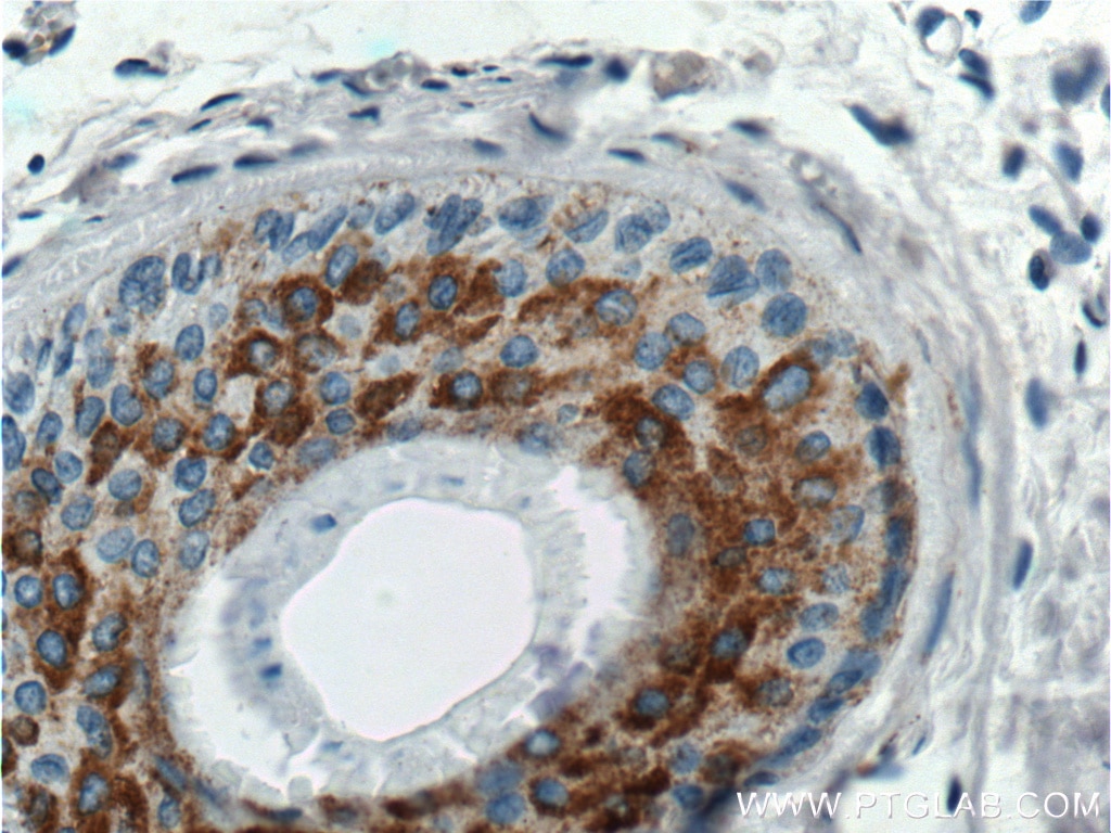 Immunohistochemistry (IHC) staining of human skin tissue using ST6GALNAC5 Polyclonal antibody (16442-1-AP)