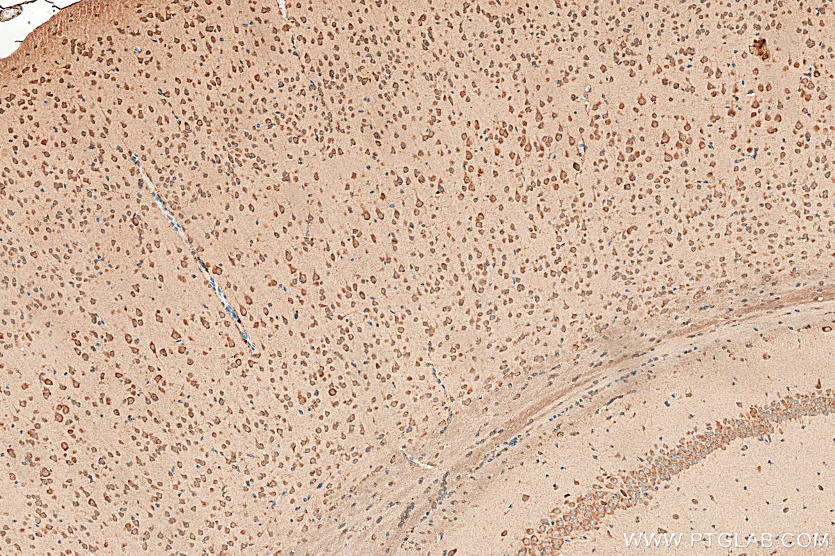 IHC staining of mouse brain using 16442-1-AP Immunohistochemistry (IHC) staining of mouse brain tissue using ST6GALNAC5 Polyclonal antibody (16442-1-AP)