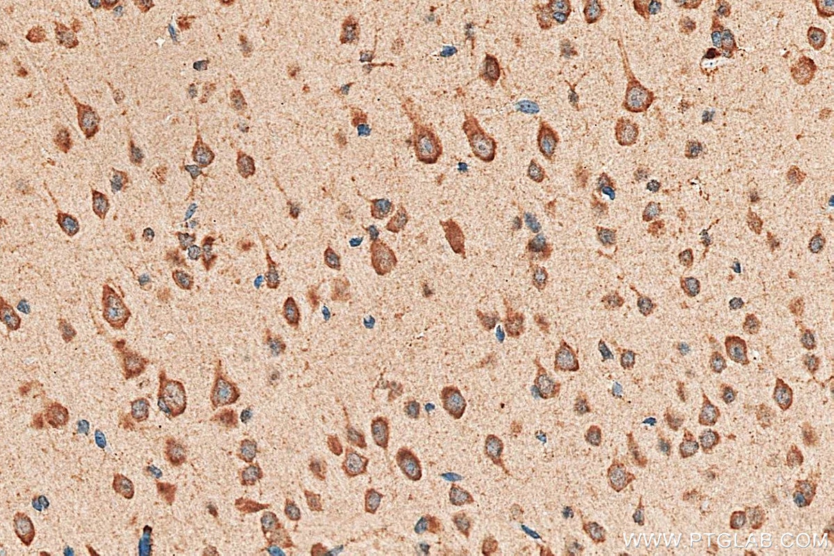 IHC staining of mouse brain using 16442-1-AP Immunohistochemistry (IHC) staining of mouse brain tissue using ST6GALNAC5 Polyclonal antibody (16442-1-AP)