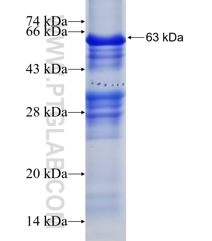 ST6GALNAC5 fusion protein Ag9767 SDS-PAGE