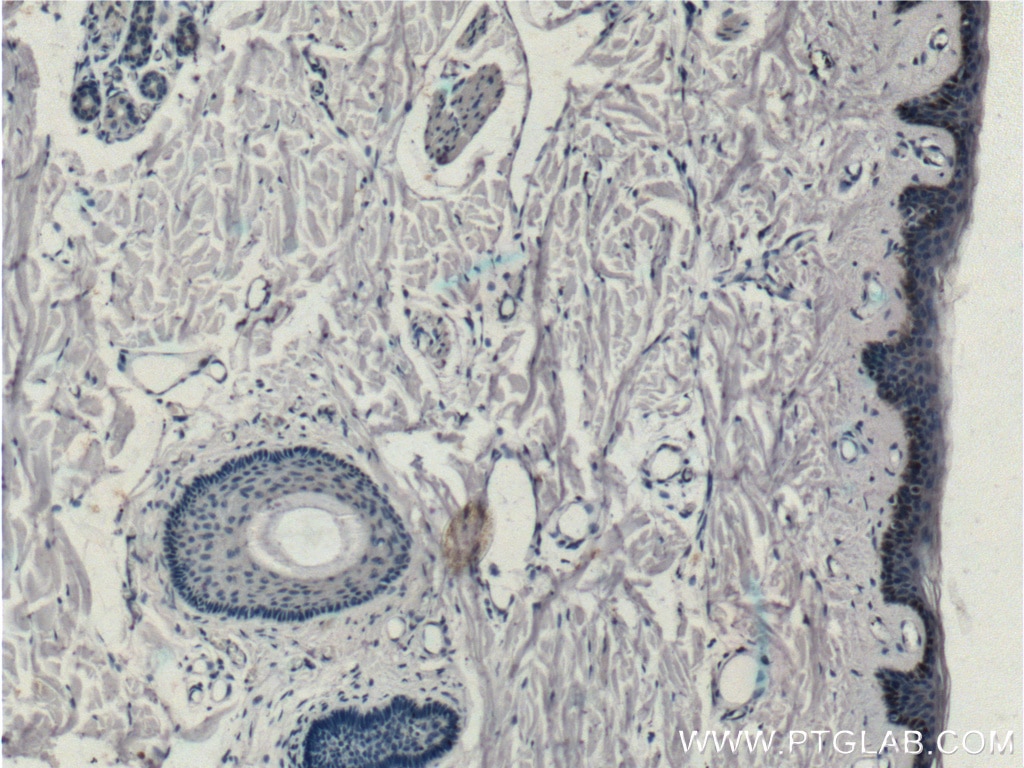 Immunohistochemistry (IHC) staining of human skin tissue using ST6GALNAC6 Monoclonal antibody (66209-1-Ig)