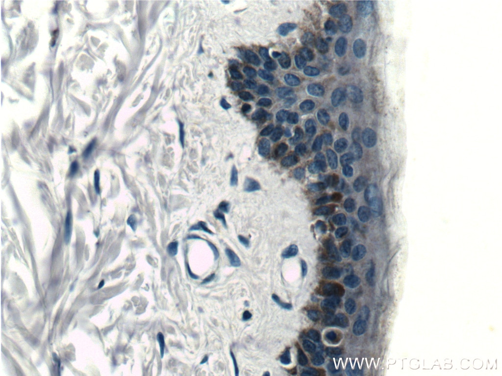 Immunohistochemistry (IHC) staining of human skin tissue using ST6GALNAC6 Monoclonal antibody (66209-1-Ig)