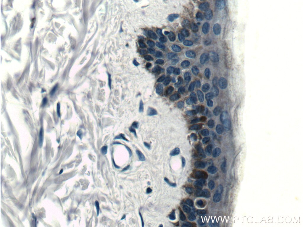 IHC staining of human skin using 66209-1-Ig