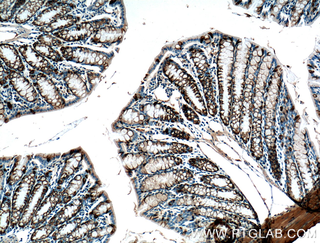 Immunohistochemistry (IHC) staining of mouse colon tissue using ST6GALNAC6 Monoclonal antibody (66209-1-Ig)