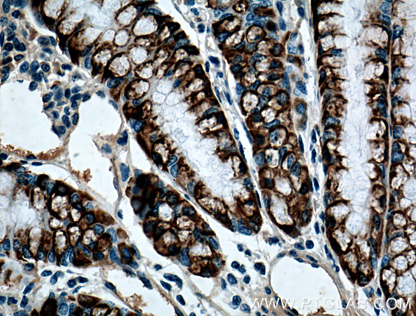 Immunohistochemistry (IHC) staining of mouse colon tissue using ST6GALNAC6 Monoclonal antibody (66209-1-Ig)