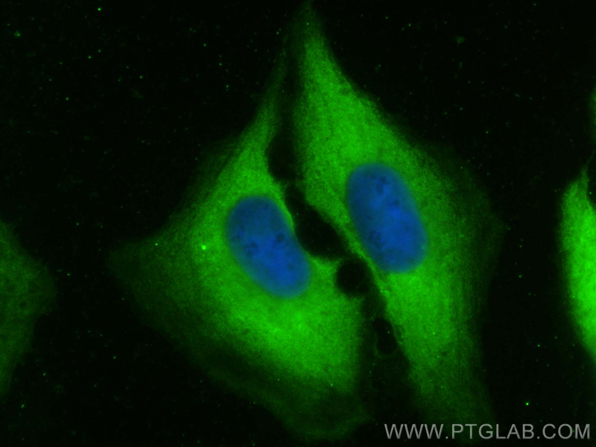 Immunofluorescence (IF) / fluorescent staining of U2OS cells using CoraLite® Plus 488-conjugated ST6GALNAC6 Monoclona (CL488-66209)