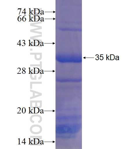 ST6GALNAC6 fusion protein Ag8358 SDS-PAGE
