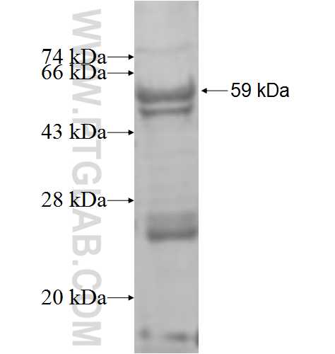 ST6GALNAC6 fusion protein Ag8475 SDS-PAGE
