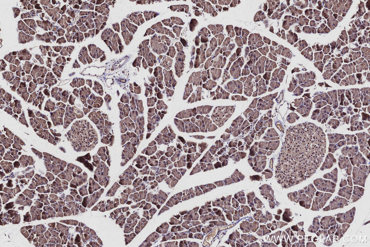 Immunohistochemistry (IHC) staining of mouse pancreas tissue using ST7 Polyclonal antibody (11945-1-AP)