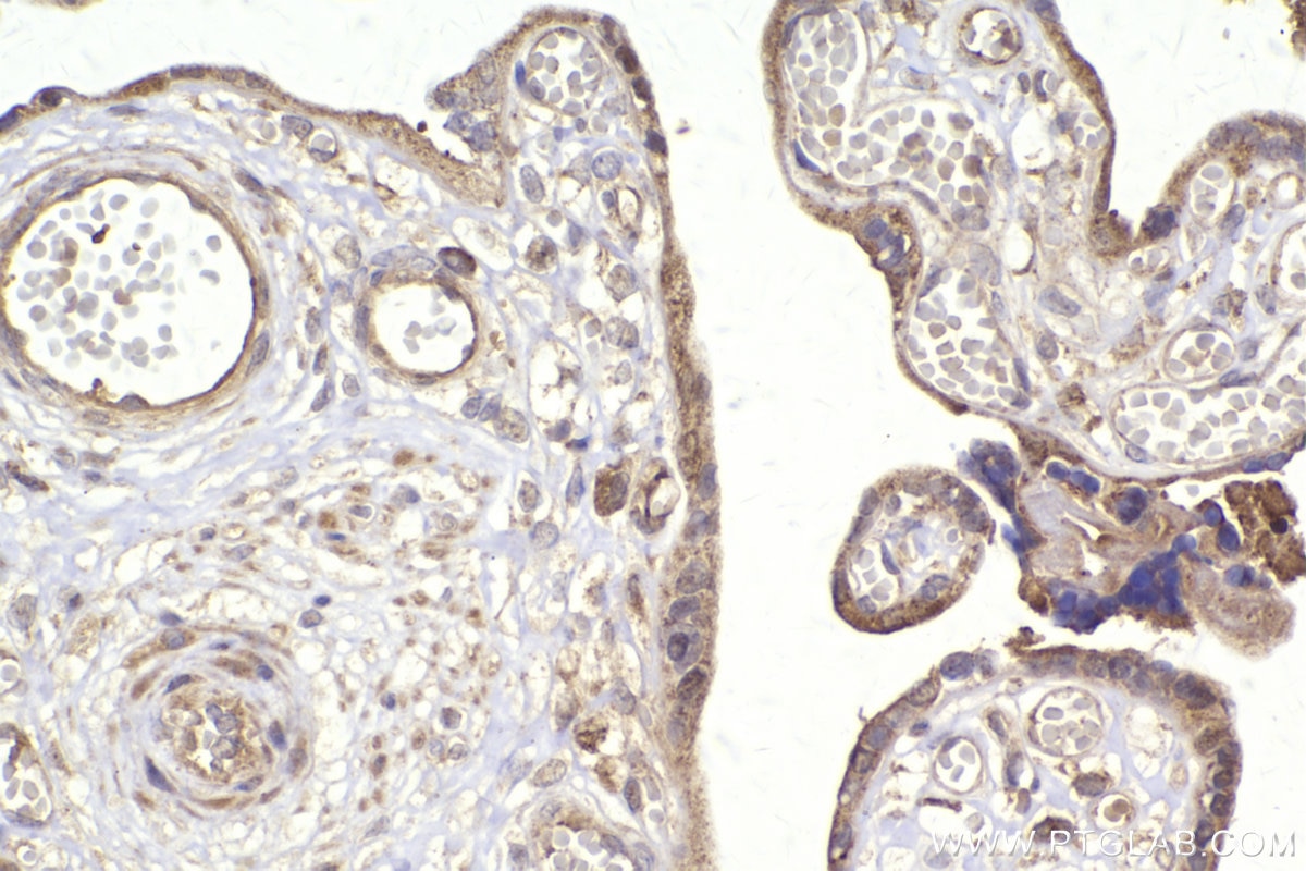 Immunohistochemistry (IHC) staining of human placenta tissue using ST7 Polyclonal antibody (11945-1-AP)