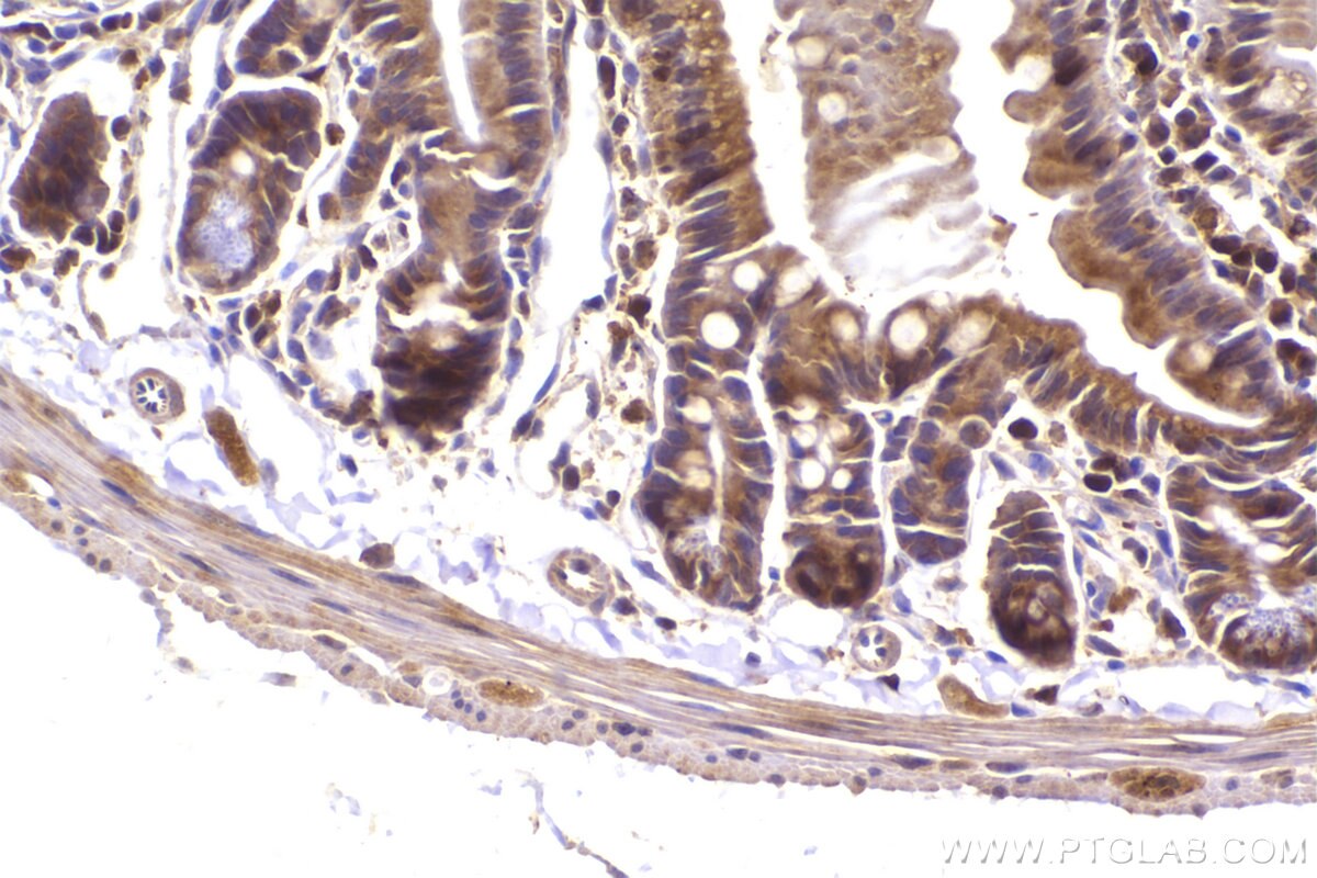 Immunohistochemistry (IHC) staining of mouse small intestine tissue using ST7 Polyclonal antibody (11945-1-AP)