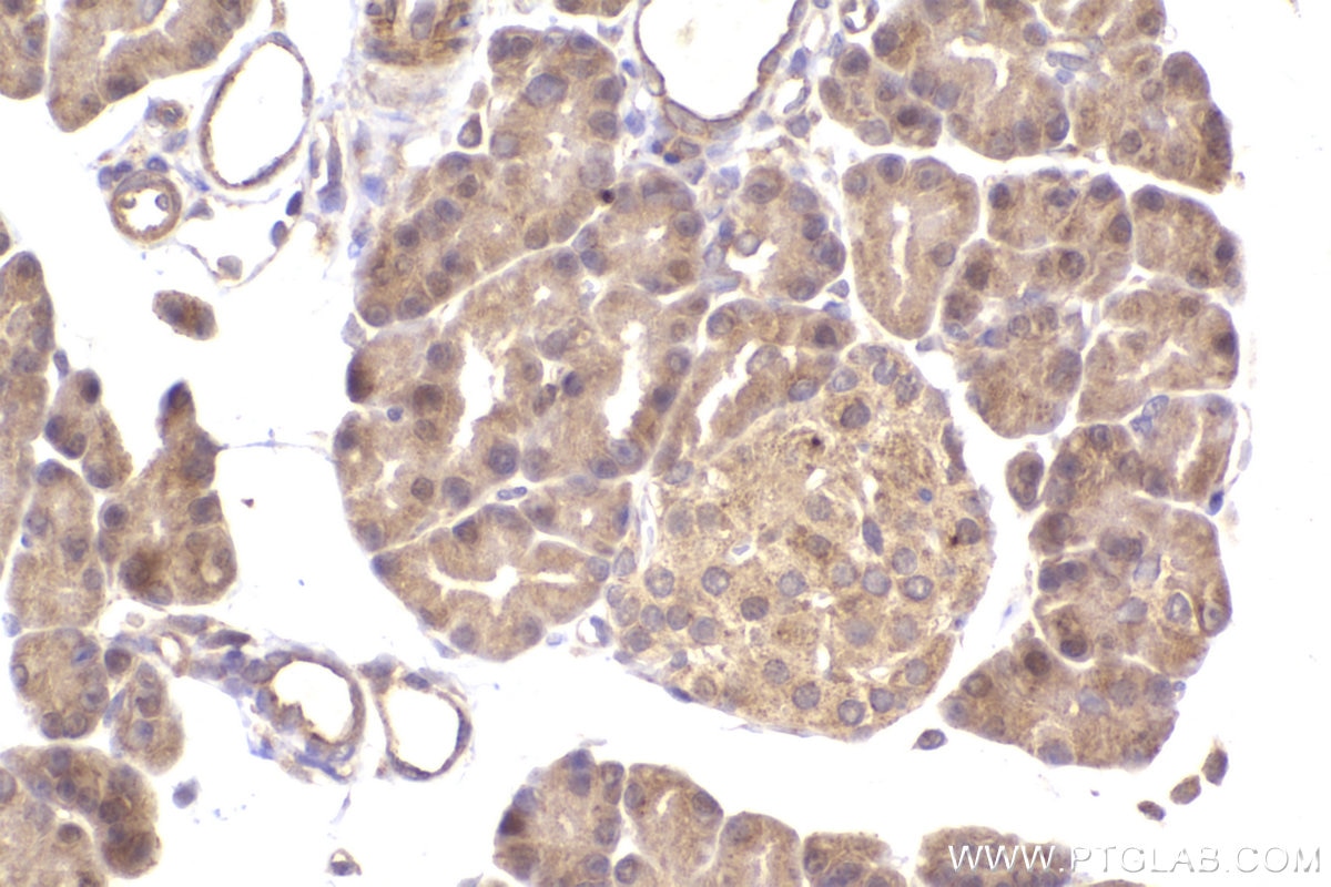 Immunohistochemistry (IHC) staining of rat pancreas tissue using ST7 Polyclonal antibody (11945-1-AP)