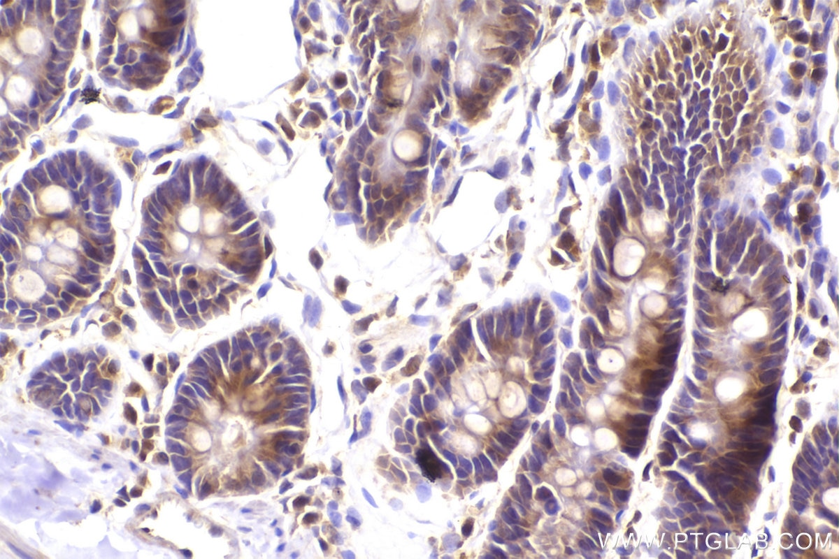 Immunohistochemistry (IHC) staining of rat small intestine tissue using ST7 Polyclonal antibody (11945-1-AP)