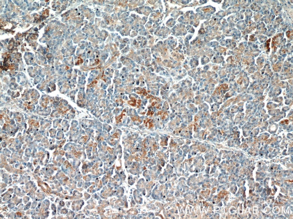 Immunohistochemistry (IHC) staining of human pancreas tissue using ST7 Polyclonal antibody (11945-1-AP)