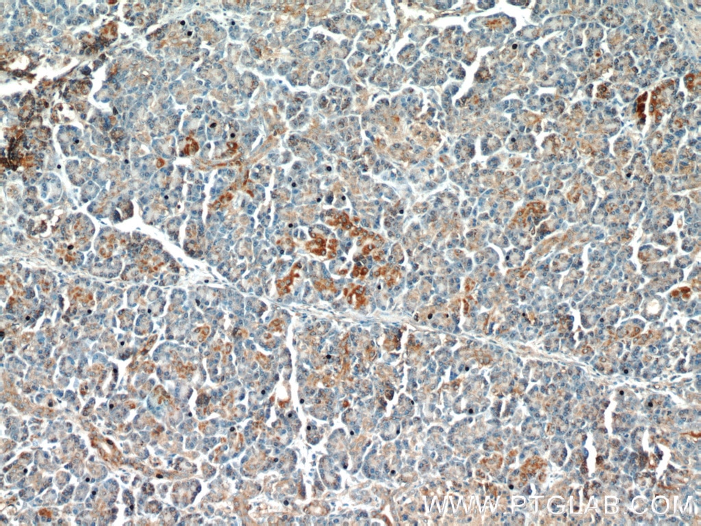 IHC staining of human pancreas using 11945-1-AP