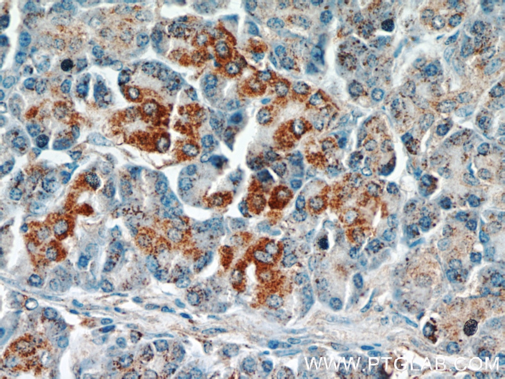Immunohistochemistry (IHC) staining of human pancreas tissue using ST7 Polyclonal antibody (11945-1-AP)
