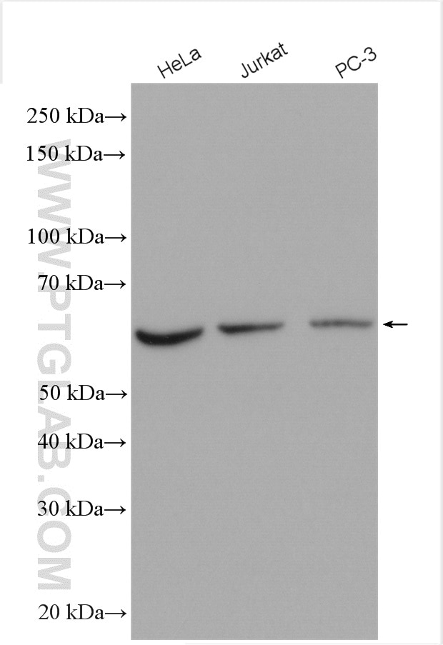 Western Blot (WB) analysis of various lysates using ST7 Polyclonal antibody (11945-1-AP)