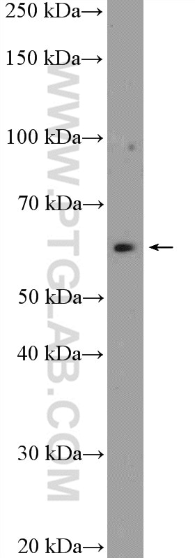 Western Blot (WB) analysis of mouse brain tissue using ST7 Polyclonal antibody (11945-1-AP)