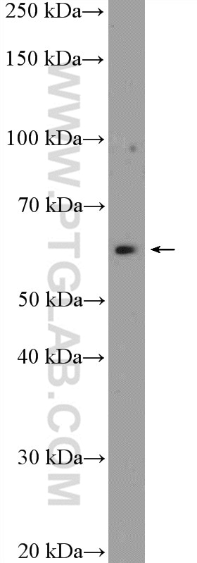 WB analysis of mouse brain using 11945-1-AP