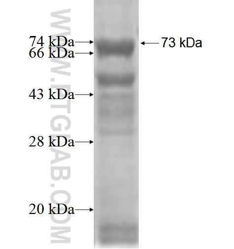 ST7 fusion protein Ag2547 SDS-PAGE