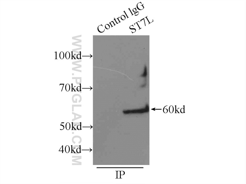 Immunoprecipitation (IP) experiment of mouse testis tissue using ST7L Polyclonal antibody (17567-1-AP)