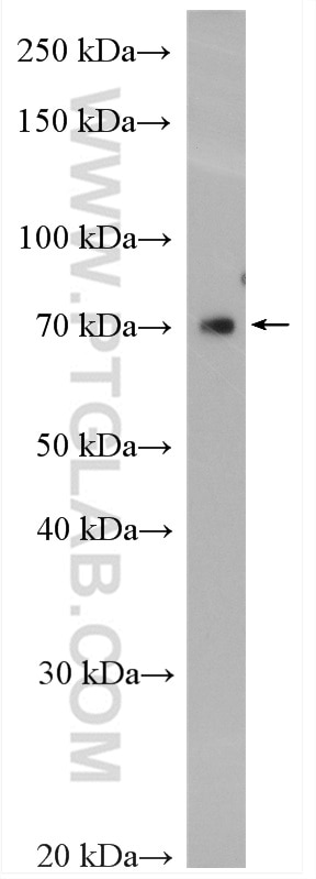 Western Blot (WB) analysis of MCF-7 cells using ST7L Polyclonal antibody (17567-1-AP)