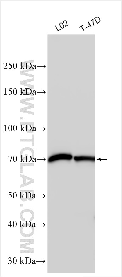Western Blot (WB) analysis of various lysates using ST7L Polyclonal antibody (17567-1-AP)