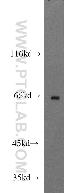 Western Blot (WB) analysis of mouse testis tissue using ST7L Polyclonal antibody (17567-1-AP)
