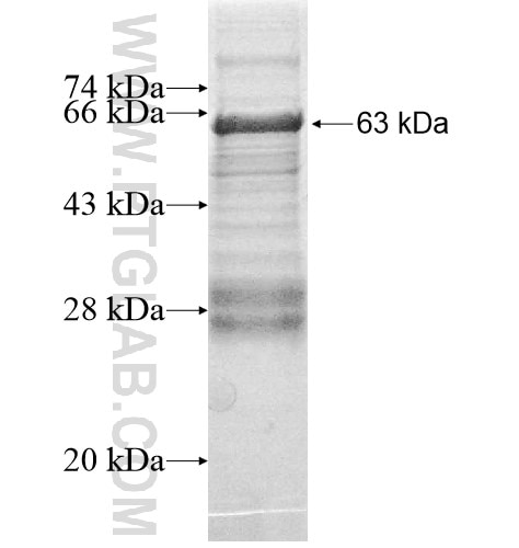 ST7L fusion protein Ag11768 SDS-PAGE