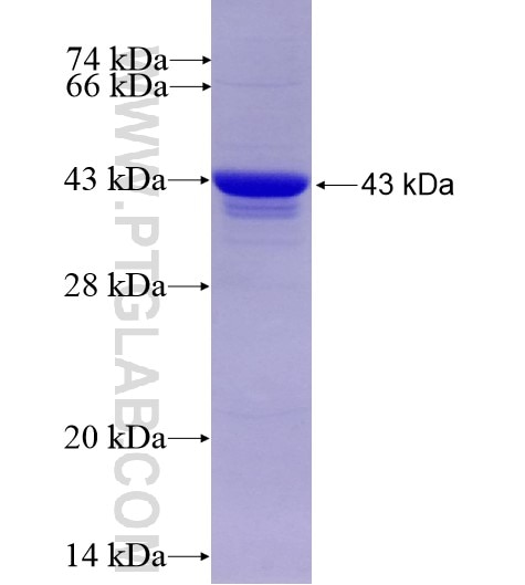 ST7L fusion protein Ag11862 SDS-PAGE