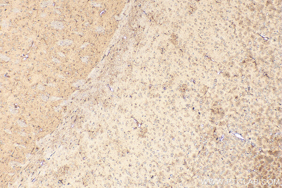 Immunohistochemistry (IHC) staining of mouse brain tissue using ST8SIA1 Polyclonal antibody (24918-1-AP)