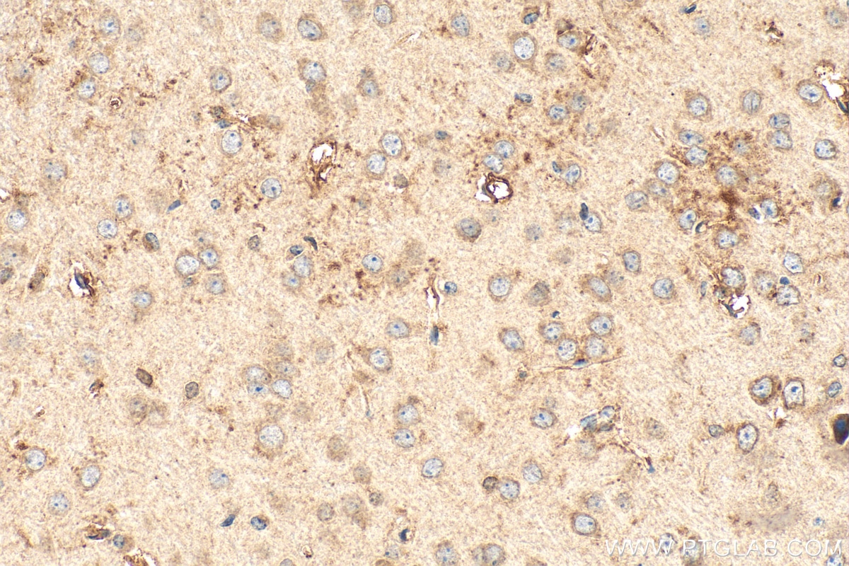 Immunohistochemistry (IHC) staining of mouse brain tissue using ST8SIA1 Polyclonal antibody (24918-1-AP)
