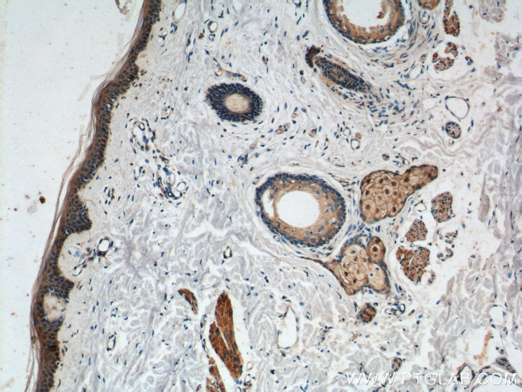 Immunohistochemistry (IHC) staining of human skin tissue using ST8SIA1 Polyclonal antibody (24918-1-AP)