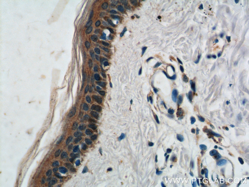 Immunohistochemistry (IHC) staining of human skin tissue using ST8SIA1 Polyclonal antibody (24918-1-AP)