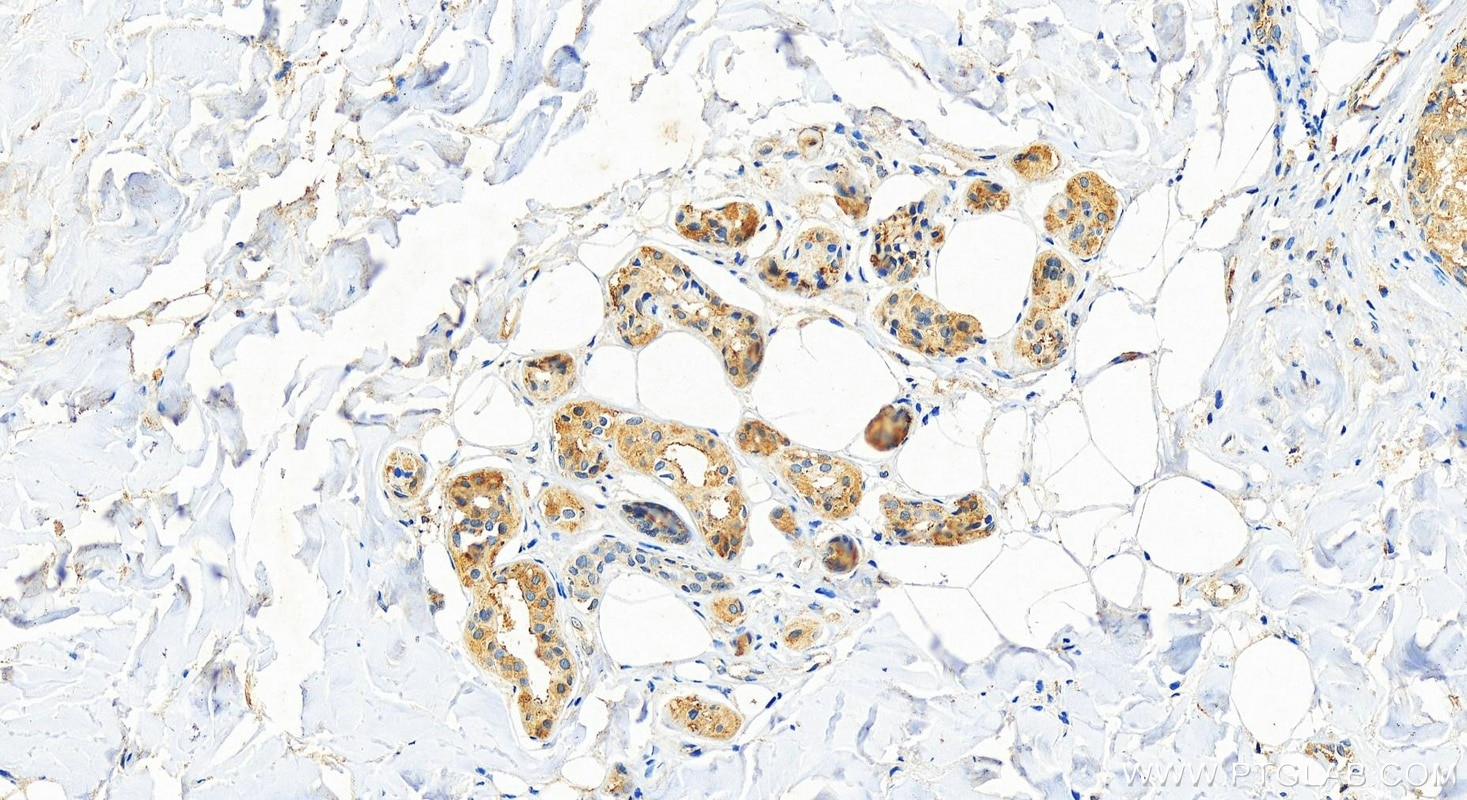 Immunohistochemistry (IHC) staining of human paracancerous of skin cancer using ST8SIA1 Polyclonal antibody (24918-1-AP)