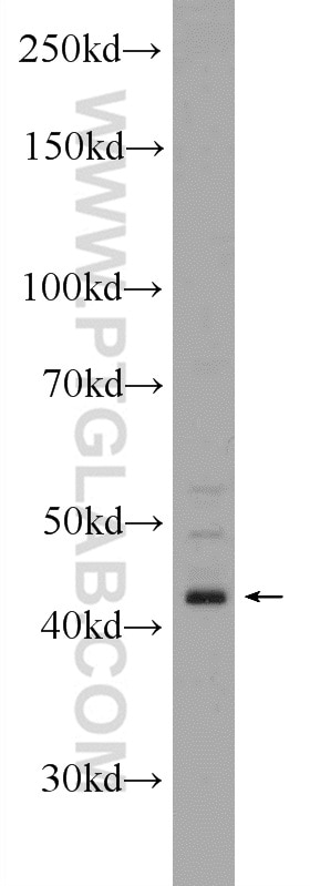 Western Blot (WB) analysis of SH-SY5Y cells using ST8SIA1 Polyclonal antibody (24918-1-AP)