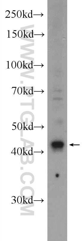 Western Blot (WB) analysis of MDA-MB-453s cells using ST8SIA1 Polyclonal antibody (24918-1-AP)