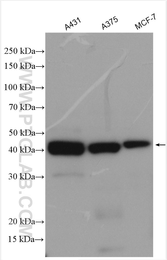 Western Blot (WB) analysis of various lysates using ST8SIA1 Polyclonal antibody (24918-1-AP)