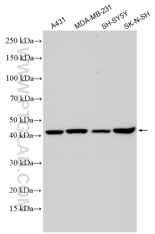 Western Blot (WB) analysis of various lysates using ST8SIA1 Polyclonal antibody (24918-1-AP)