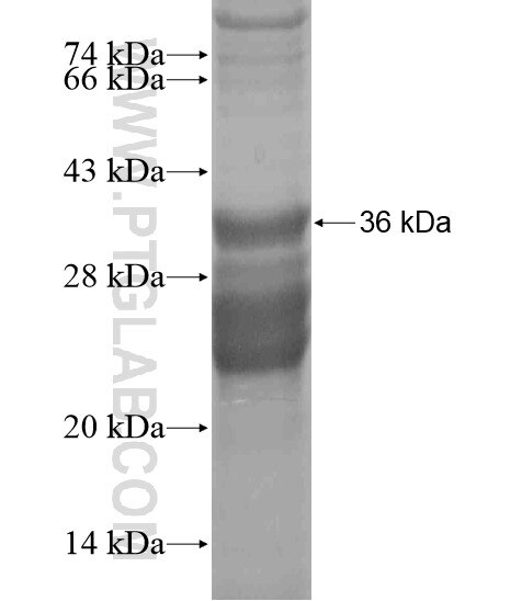 ST8SIA1 fusion protein Ag20429 SDS-PAGE