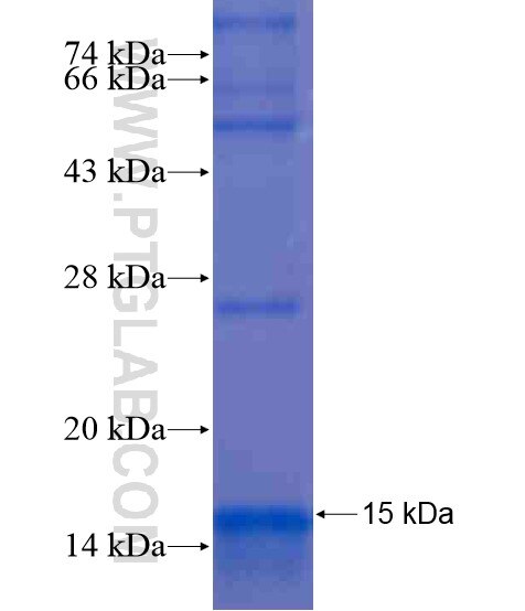 ST8SIA1 fusion protein Ag20497 SDS-PAGE