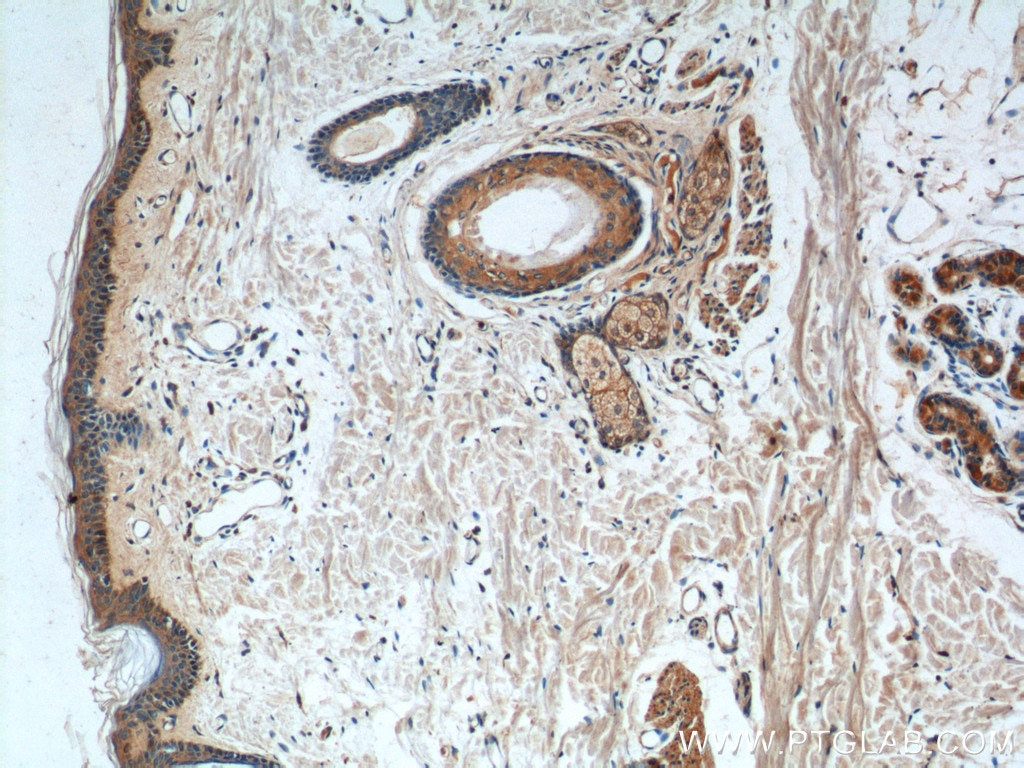 Immunohistochemistry (IHC) staining of human skin tissue using ST8SIA2-Specific Polyclonal antibody (19736-1-AP)