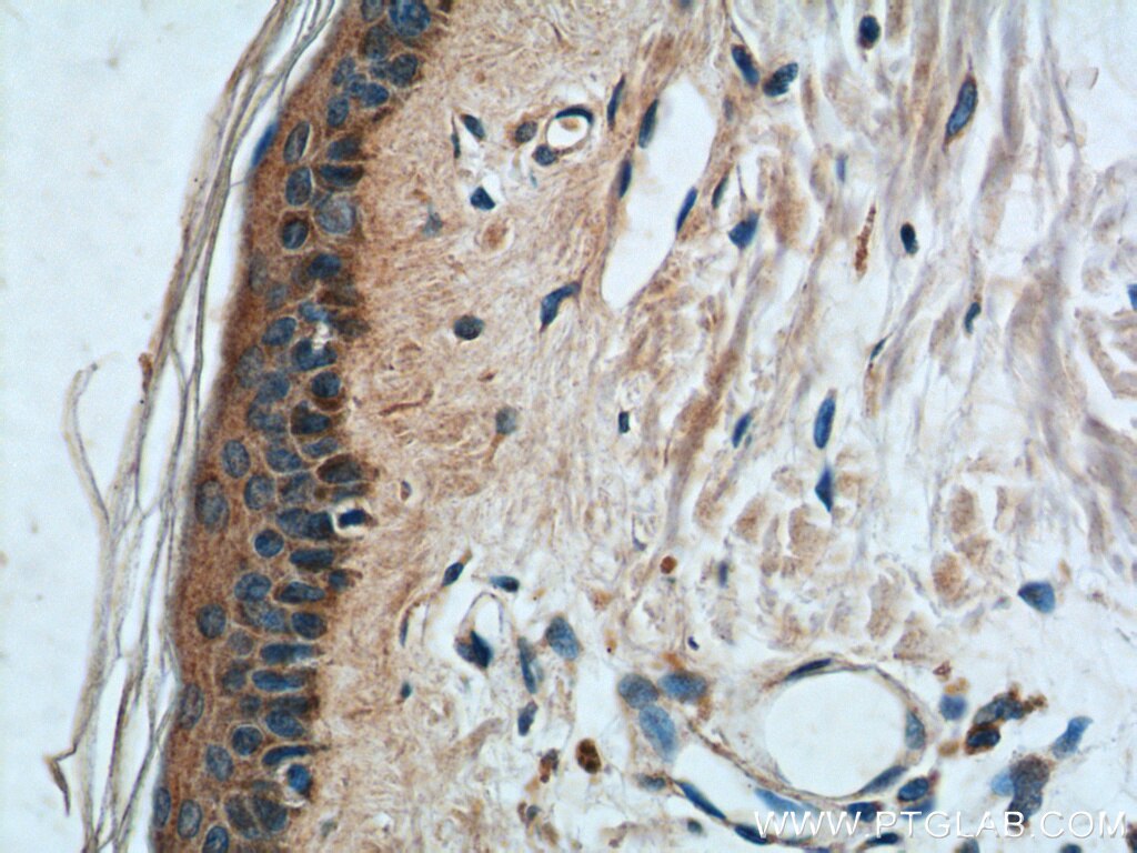 Immunohistochemistry (IHC) staining of human skin tissue using ST8SIA2-Specific Polyclonal antibody (19736-1-AP)