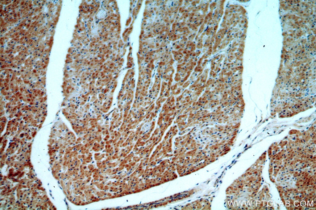 Immunohistochemistry (IHC) staining of human heart tissue using ST8SIA2-Specific Polyclonal antibody (19736-1-AP)