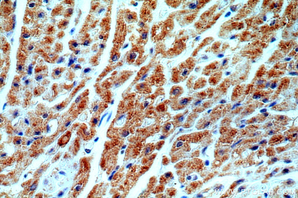 Immunohistochemistry (IHC) staining of human heart tissue using ST8SIA2-Specific Polyclonal antibody (19736-1-AP)